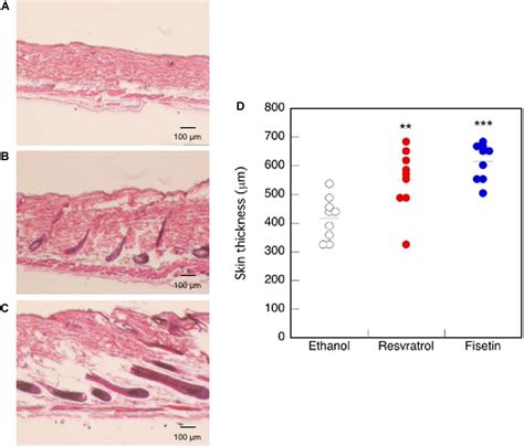 Frontiers Fisetin Promotes Hair Growth By Augmenting Tert Expression