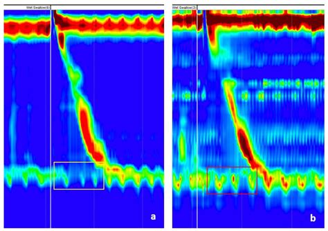 Sensors Free Full Text Integrated Relaxation Pressure