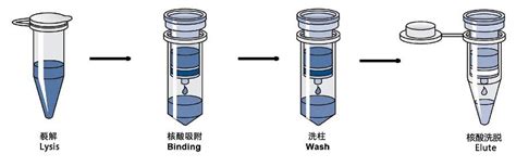 Dna提取试剂盒有哪些种类？各种类产品的优缺点又是什么？ 检测