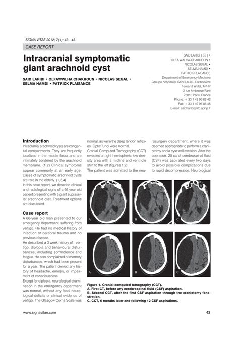 Pdf Intracranial Symptomatic Giant Arachnoïd Cyst