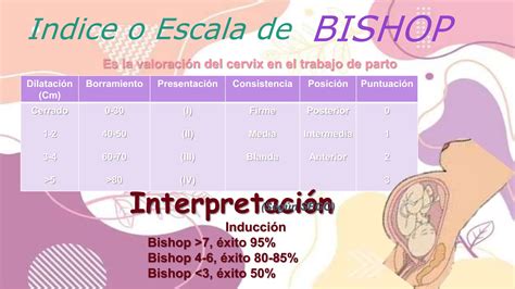 Escala de Bishop en la Inducción del Trabajo de Parto PPT