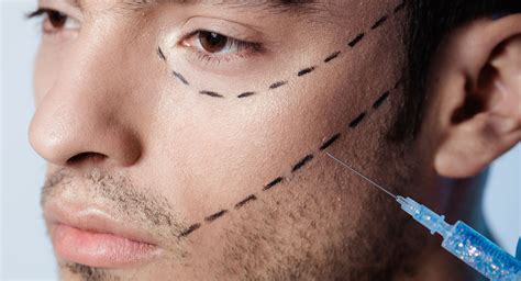 ‘brotox The Rising Trend Of Botox Treatments For Men A New You