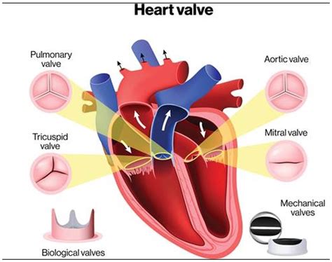 Heart valve simulation shifts the treatment paradigm - StarFish Medical