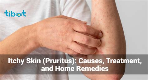 Itchy Skin Pruritus Causes Treatment And Home Remedies