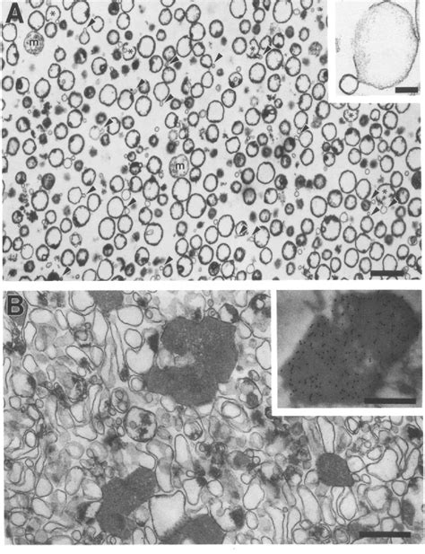 Figure 3 From Giant Peroxisomes In Oleic Acid Induced Saccharomyces