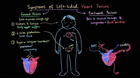 Signs Of Heart Failure : NCLEX Question: CHF Manifestations of Right ...