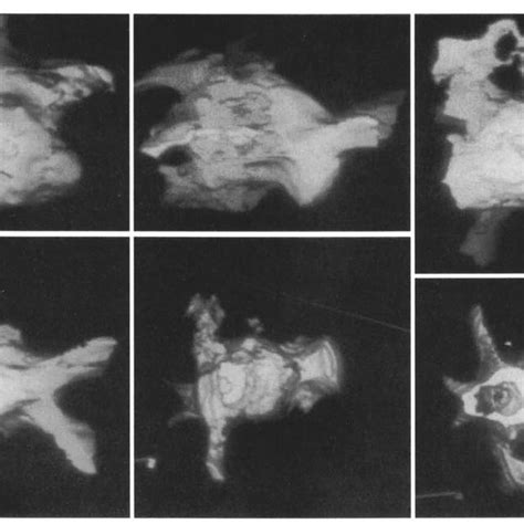 Figure Three Dimensional Reconstruction Of Computed Tomographic Images Download Scientific