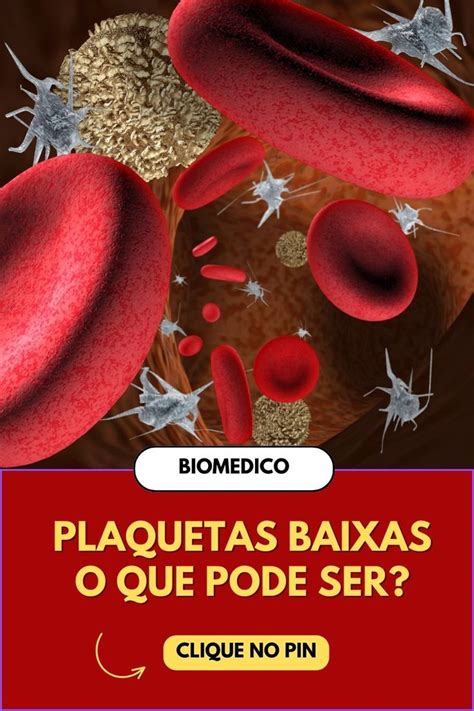 O Que Significa Plaquetas Baixas No Sangue Em Hematologia