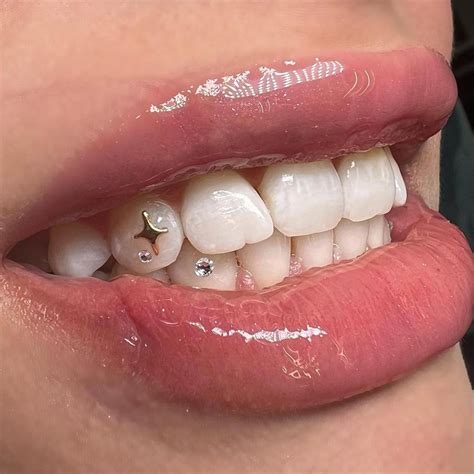 Tooth Gems All You Should Know About Teeth Jewelry Teeth Jewelry