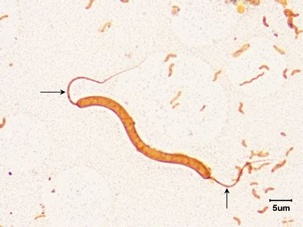 Microbiology Lectures 4 7 Flashcards Quizlet