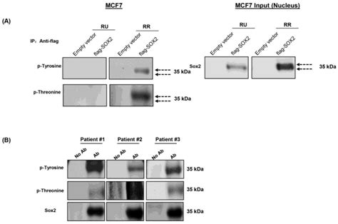 Rr Cells Had Higher Phosphorylation Of Sox Immunoprecipitation