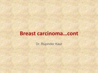 Breast Malignant Lesions In Situ Lesions Mbbs Ppt