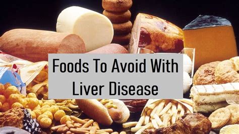 8 Foods To Avoid With Liver Disease List