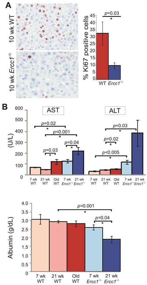 A Mouse Model Of Accelerated Liver Aging Caused By A Defect In Dna