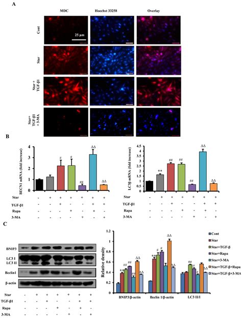 Tgf Enhanced Autophagy In Star Treated Nih T Fibroblasts Cells