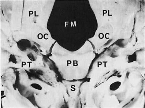 2 Depiction Of The Foramen Magnum By The Second Year Of Life Fm