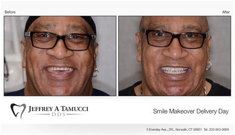 Before And Afters Jeffrey A Tamucci Dds Dental Office Ct