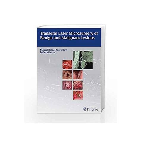 Transoral Laser Microsurgery Of Benign And Malignant Lesions By Bernal Sprekelsen M Buy Online