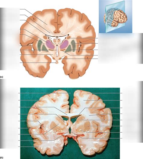 Mid Sagittal Brain Diagram Quizlet