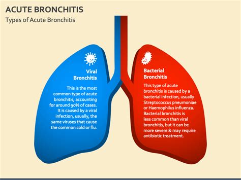 Free Acute Bronchitis Powerpoint And Google Slides Template Ppt Slides