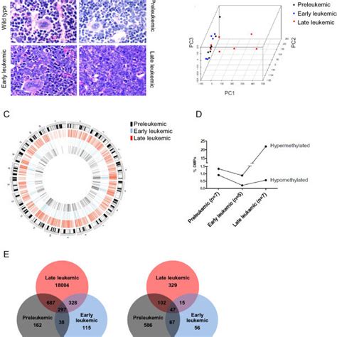 Disease Progression And Accompanying Global DNA Methylation In The PU 1