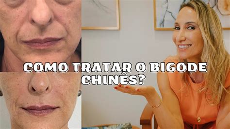 Como Tratar O Bigode ChinÊs MaÍra Platero Youtube