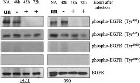 Phospho Egfr Is Downregulated After E6e7 Repression In Hpv Type 16