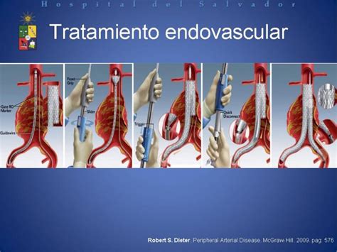 Presentaciones Depto Cirug A Hospital Del Salvador