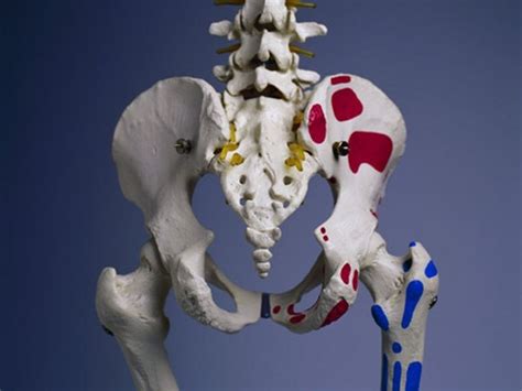 MRI indicates sacroiliitis in some healthy individuals