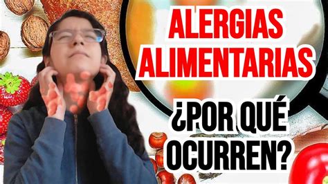 Por Qu Se Producen Las Alergias Alimentarias Todo Lo Que Debes Saber