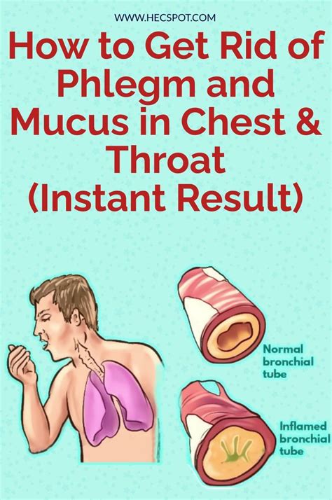 How To Get Rid Of Phlegm And Mucus In Chest Throat Instant Result