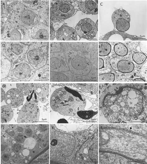 Electron Microscopic Analysis Of Spermatogenic Cells And Sertoli Cells