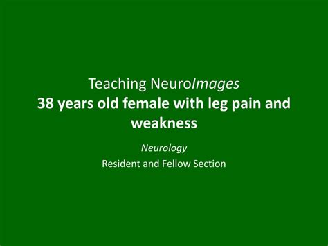 Ppt Teaching Neuro Images 38 Years Old Female With Leg Pain And Weakness Powerpoint