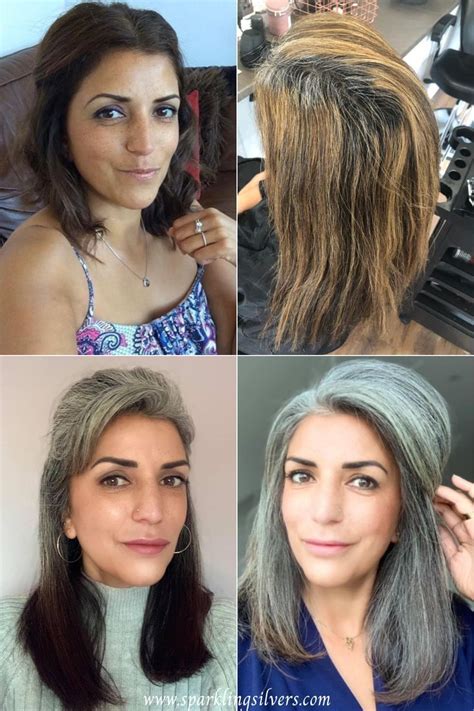 Amazing Before And After Going Gray Pictures With Transition Stories