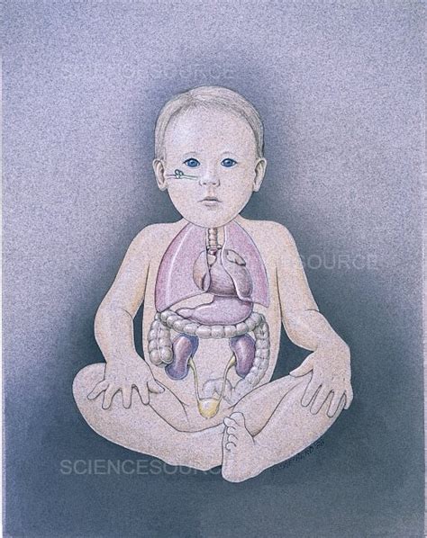 Photograph Anterior View Of Child Science Source Images