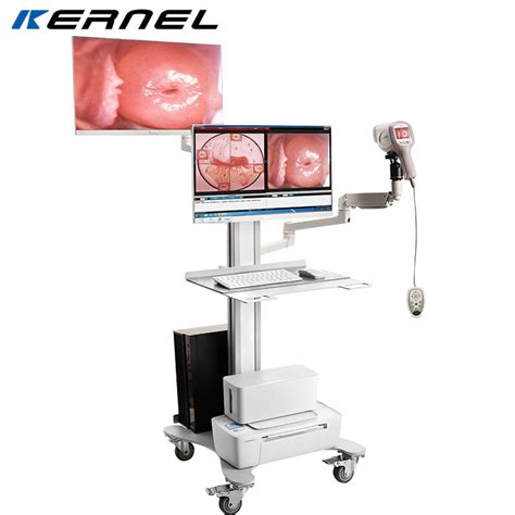 Hospital Gynecology Video Vaginal Endoscope Portable Trolley HD Digital