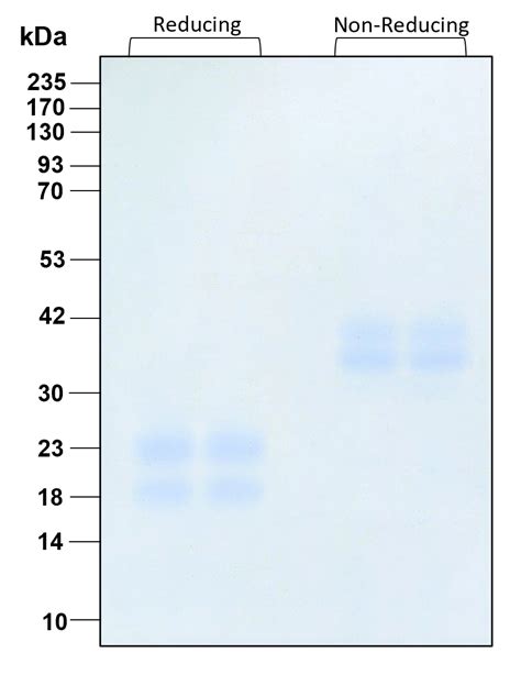 Humankine® Recombinant Human M Csf Protein Proteintech