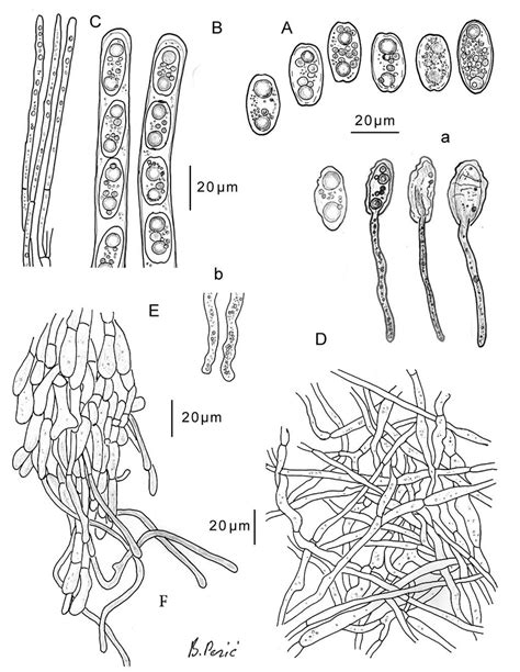 − Sarcoscypha Jurana Photo B Perić A − Ascospores A −