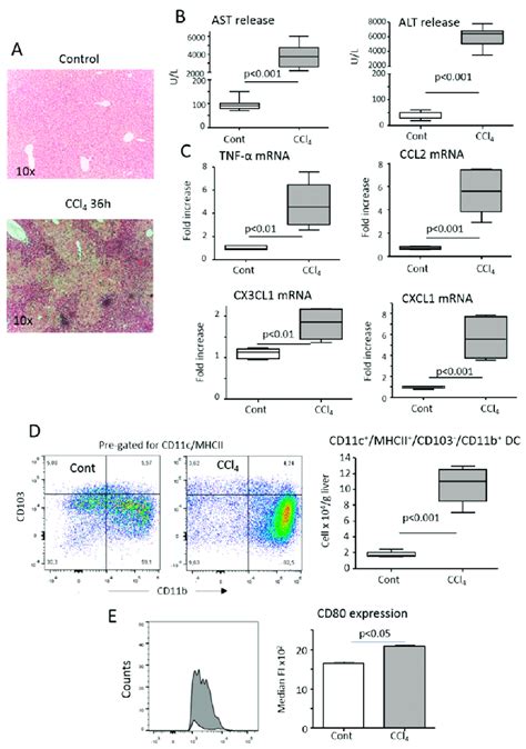 Hepatic Inflammation Induced By The Acute Administration Of Ccl4