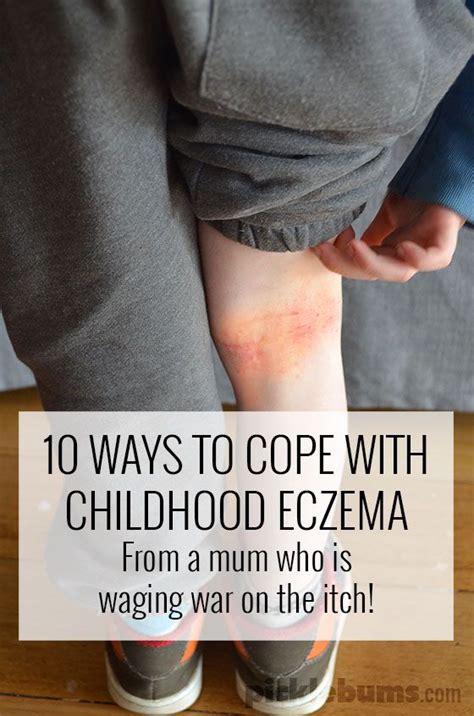 10 Ways To Cope With Childhood Eczema Eczema Kids Health Psoriasis