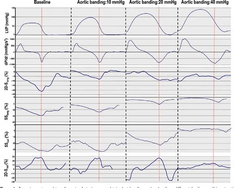 Figure 1 From Influence Of Afterload On Left Ventricular Radial And