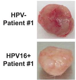 Hpv 16 positiv – Anti-rynke krem