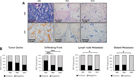 Figure 2 from Altered expression of fibroblast activation protein-α ... 