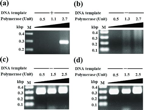 Amplification Of The S Rrna Gene With Or Without A Dna Template Pcr