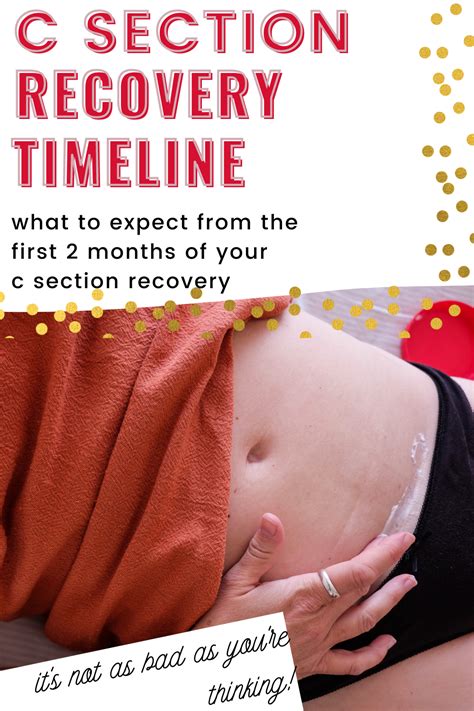 C Section Recovery Timeline A Week By Week Look At Recovery