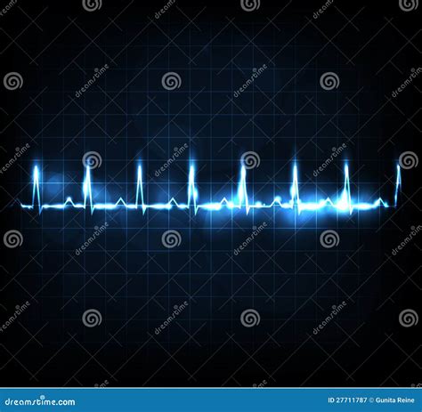 Heart Rate Zones Vector Illustration Pulse Intensity Educational