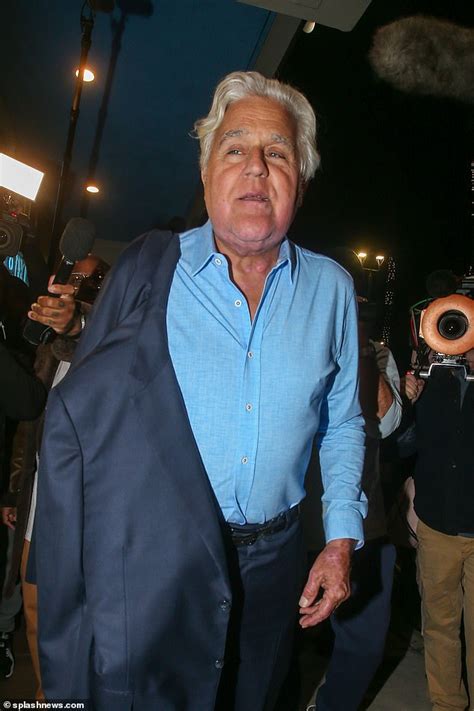 My Face Caught On Fire Jay Leno Details Serious Burn Injuries After