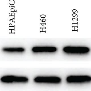 Trim Is Highly Expressed In Nsclc Cells A B Relative Expression