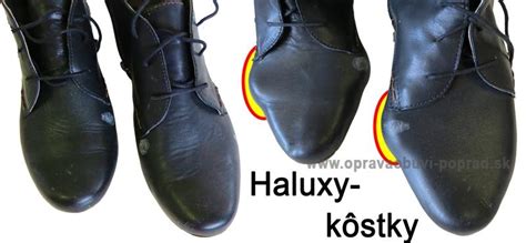 Galéria – Oprava obuvi – kategórie - Opravaobuvi-poprad.SK
