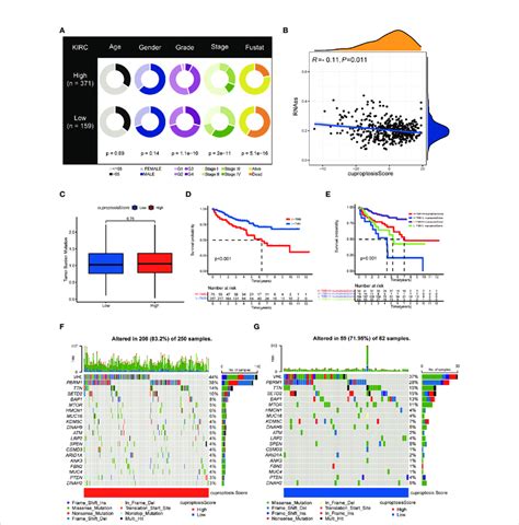 Clinical And Genetic Correlation Of Cuproptosis Score A